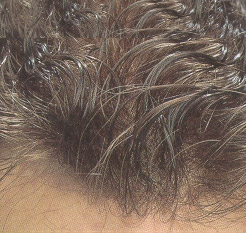 Hair Consultants in Palm Springs, CA | Hair Replacement in Palm Springs, CA Hair Consultants in Palm Springs, CA | Hair Replacement in Palm Springs, CA